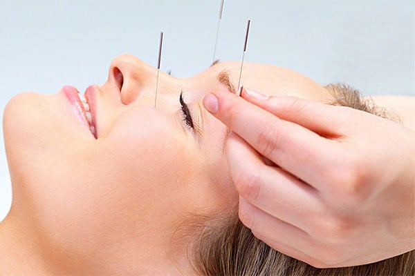 Acupuncture cruise highlight