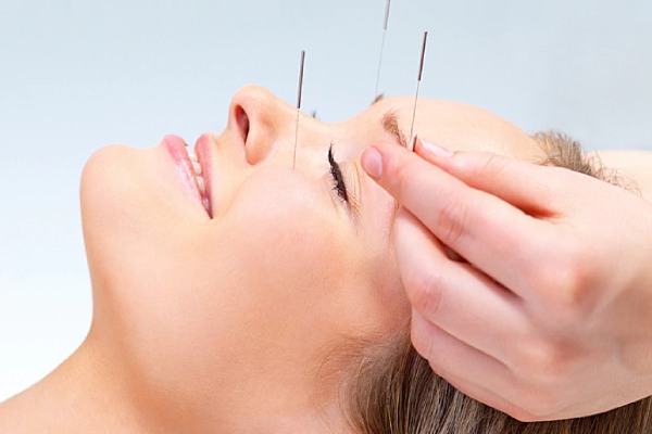 Acupuncture cruise highlight