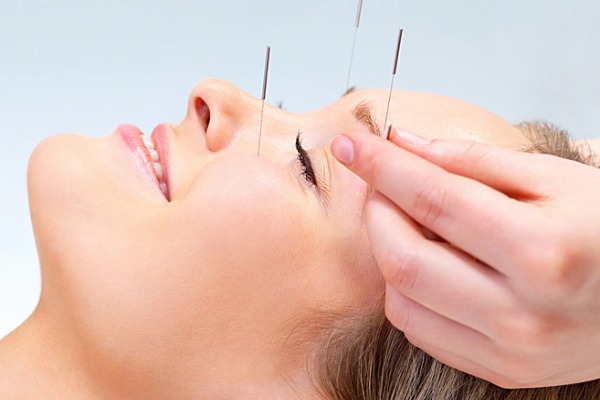Acupuncture cruise highlight